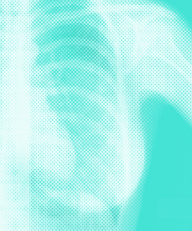 Mammogram_opener