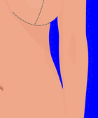 What To Know Before Getting A Boob Job