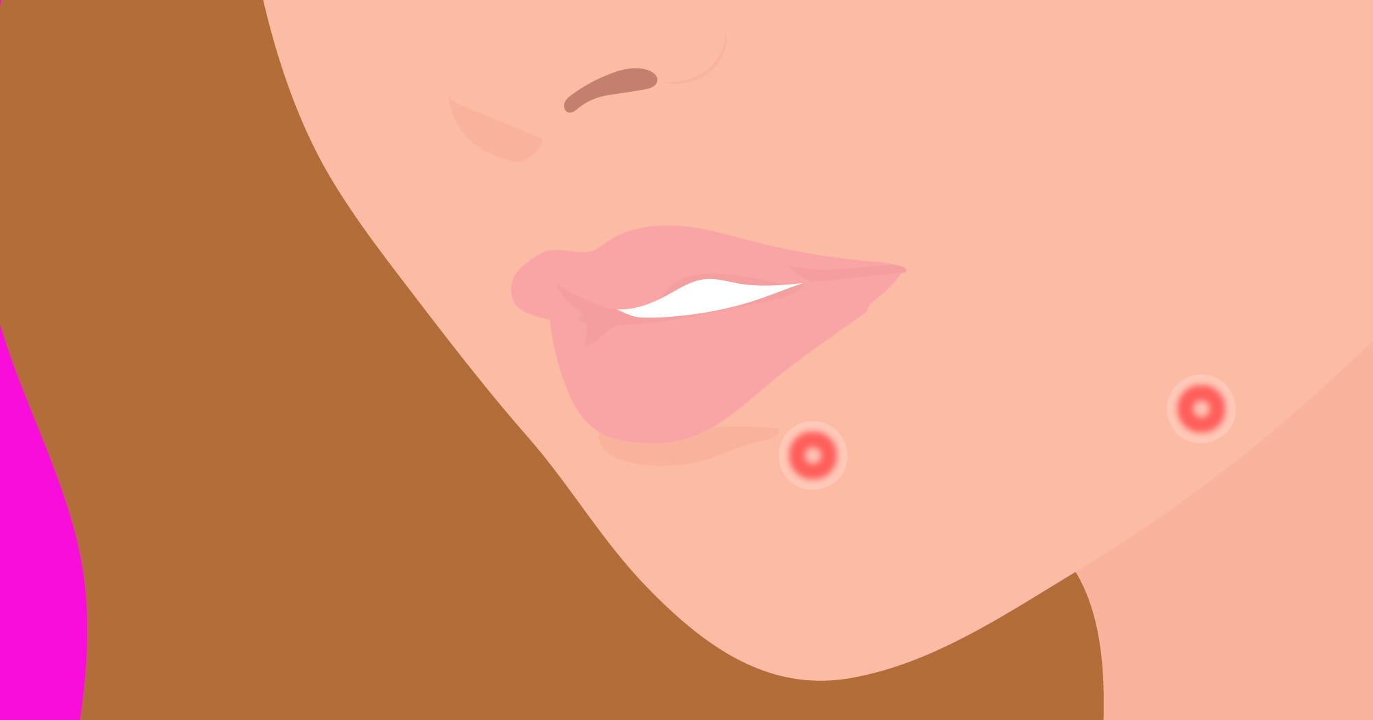 Best Acne Treatments Renee Rouleau Emergency Zit Kit