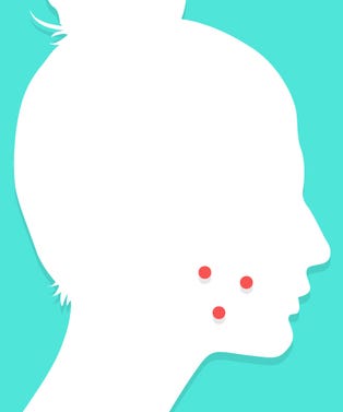 Acne_opener