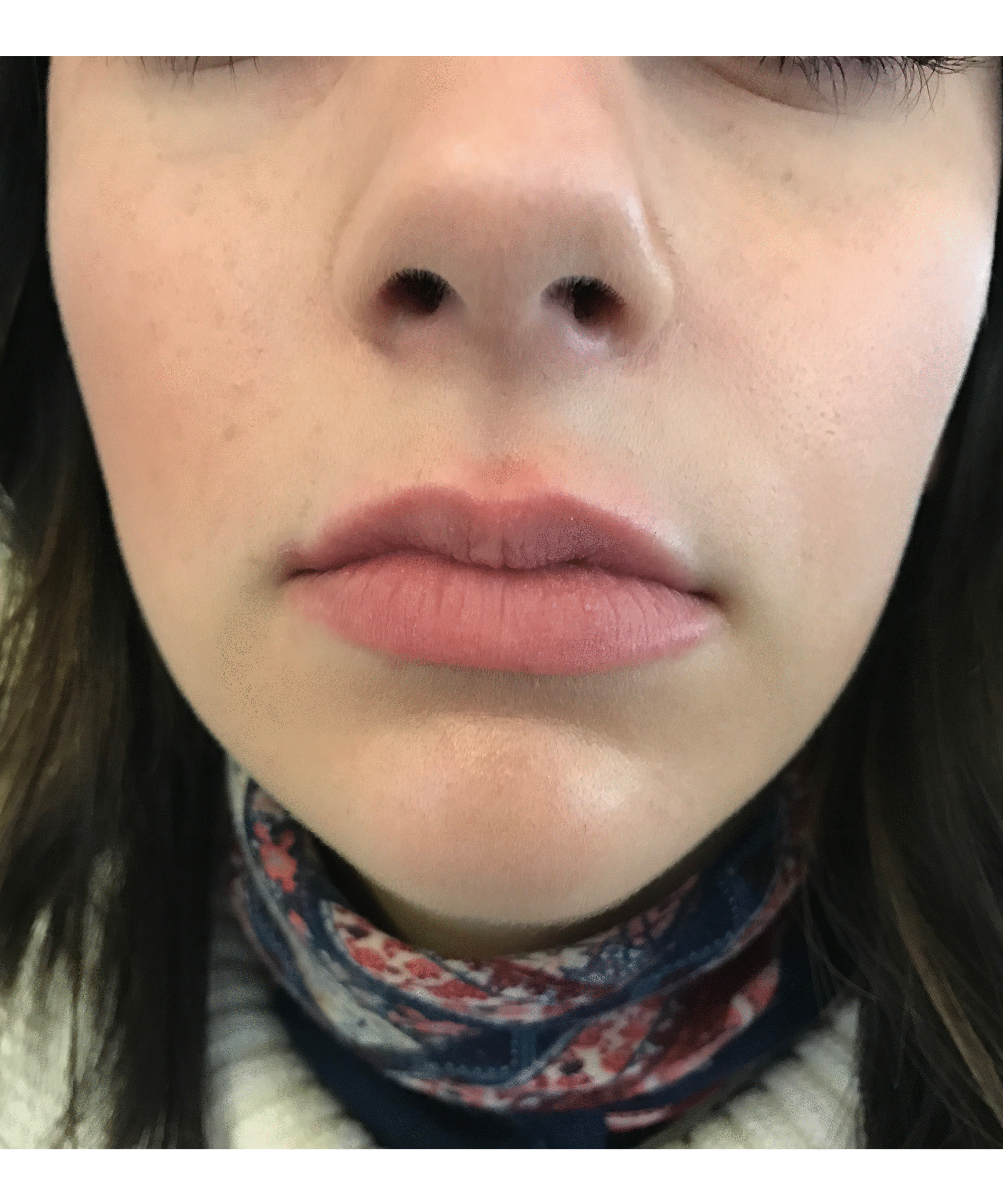 PMD Beauty Kiss Vacuum Lip Vibrating Device Review