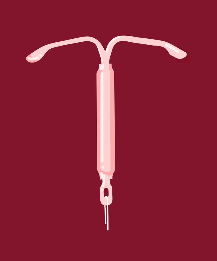 iud types