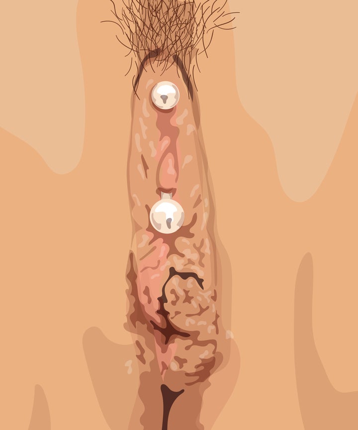 Clit piercings illistrated Clit piercings illistrated