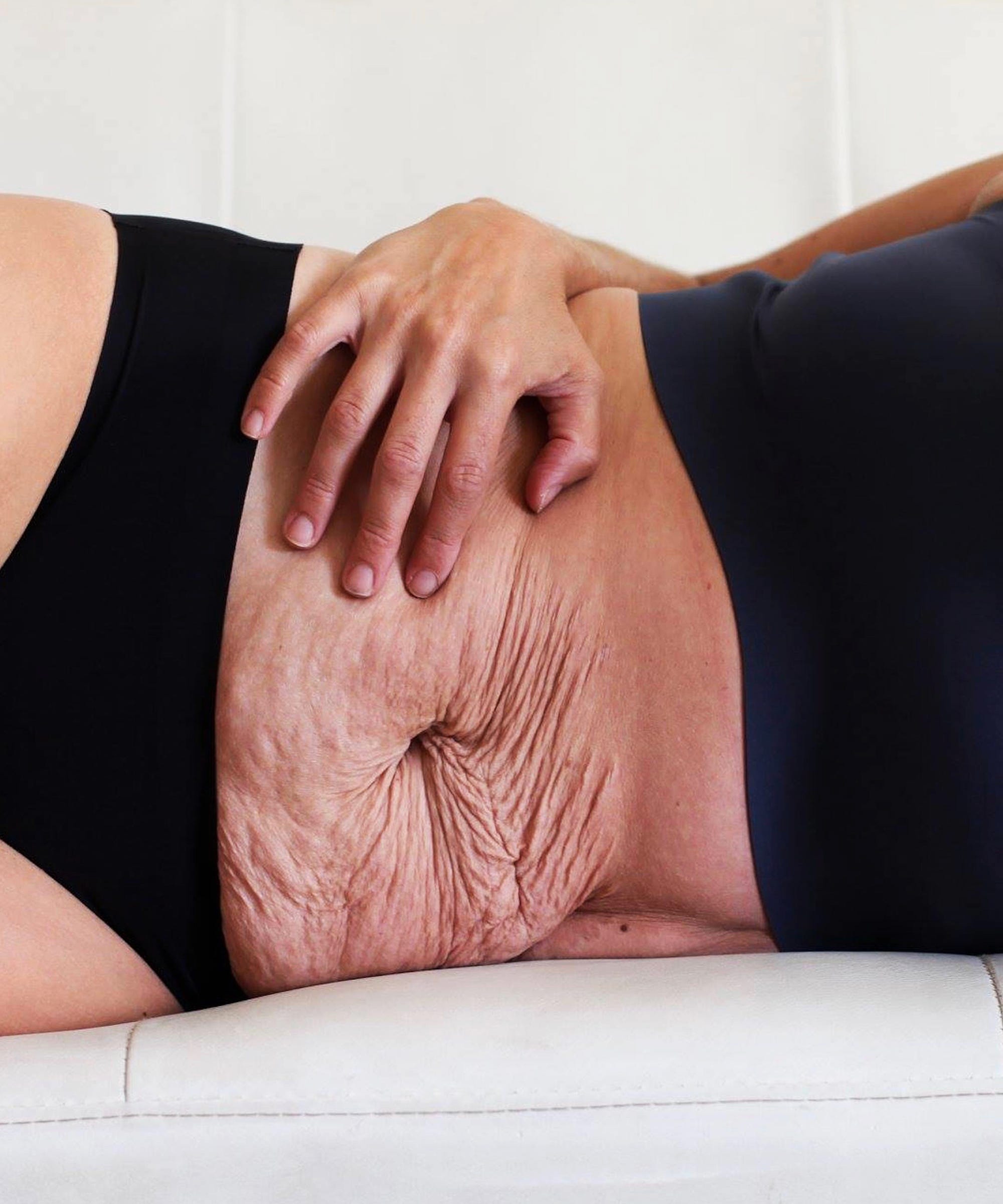 These Photos Celebrate The Beauty Of Postpartum Bodies