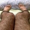 hairy leg op