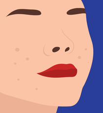 NaturalWaysToLightenAcneScars_JasminValcourt-opener