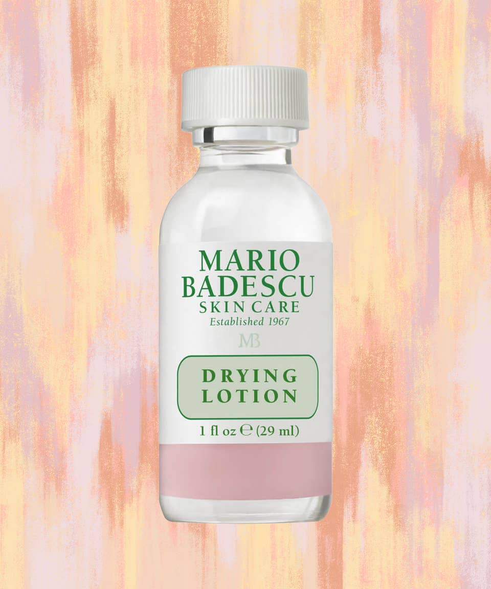 drying lotion on cystic acne