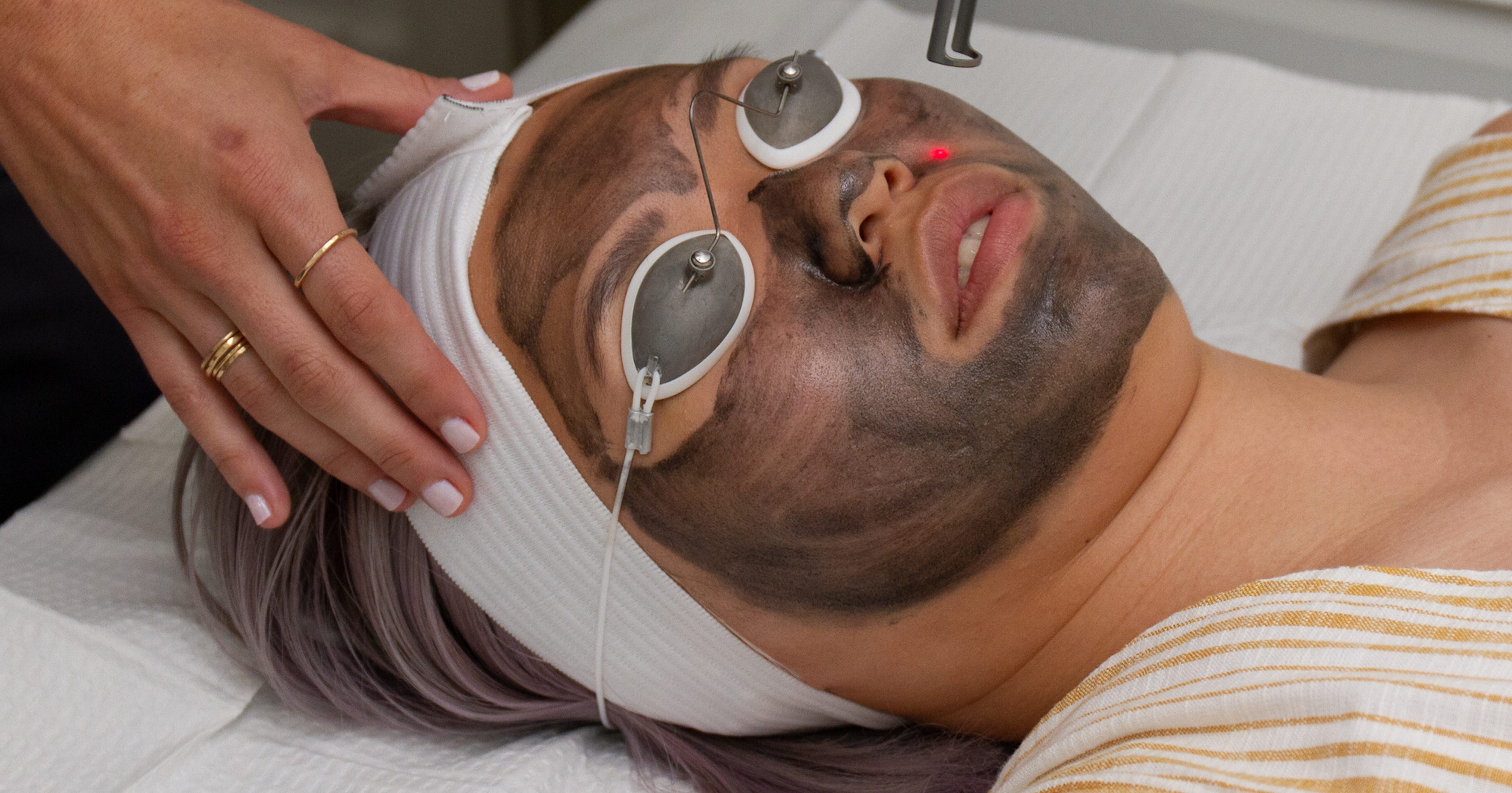 I Got A Charcoal Laser Facial For Acne at Skin Laundry