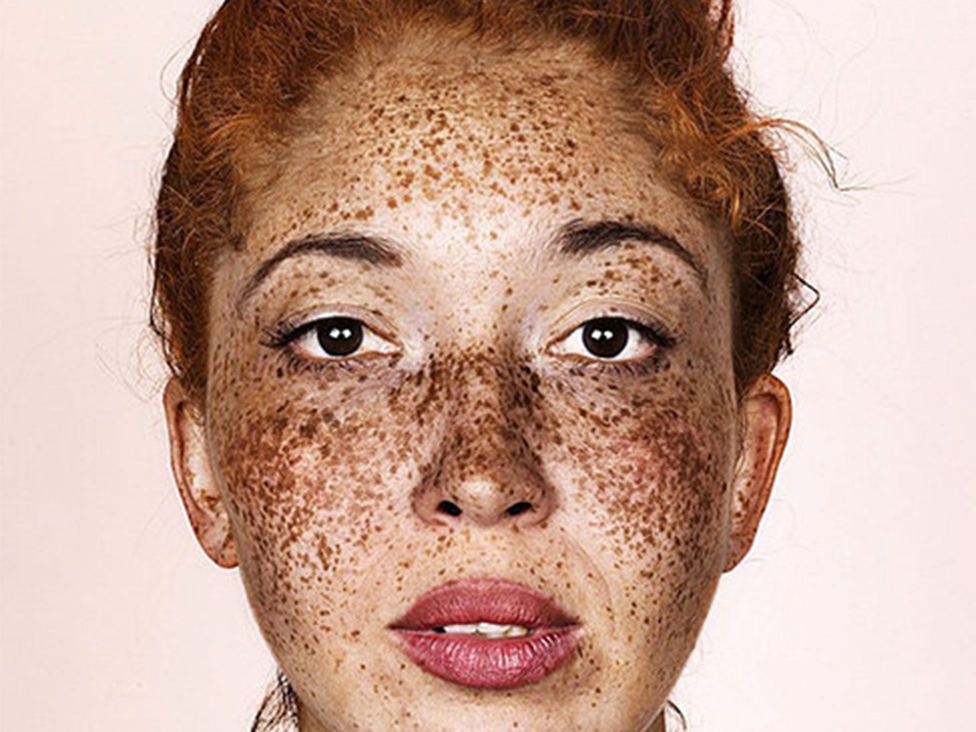 What Do Freckles On The Lips Mean